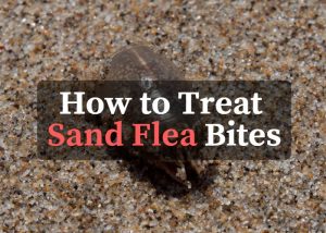 How To Treat Sand Flea Bites