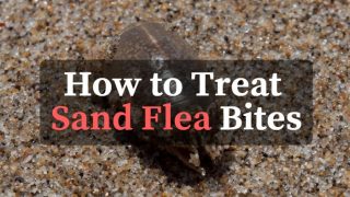 treat sand flea bites